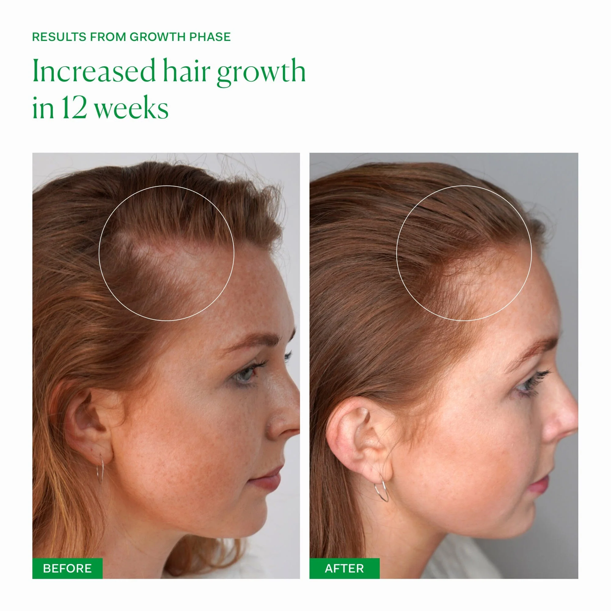 Growth Phase - Image 4