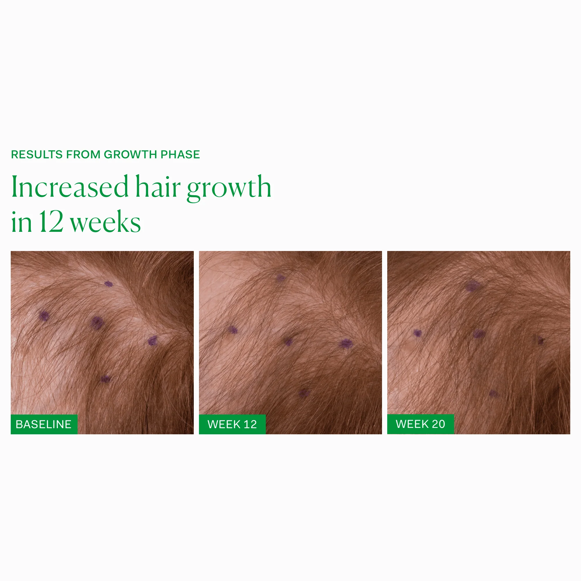 Growth Phase - Image 5